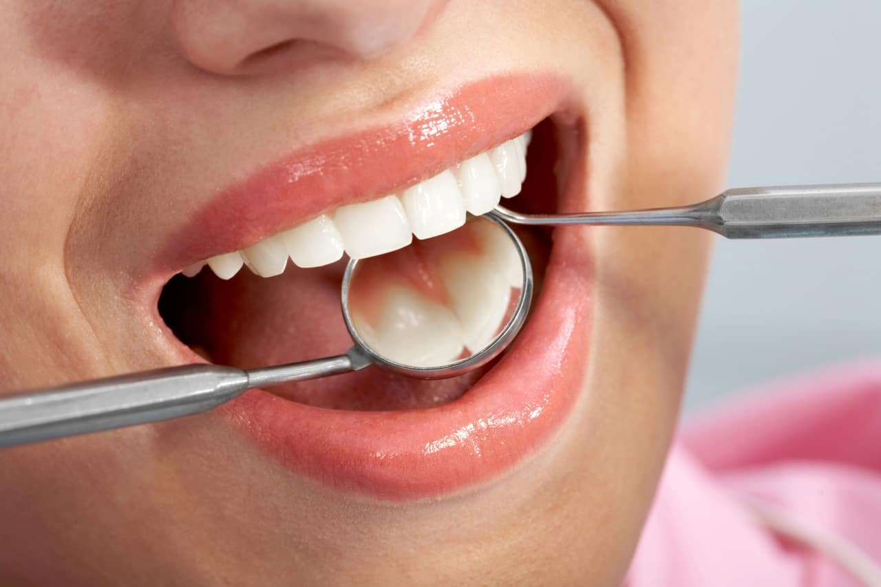 How long do tooth fillings take? Time Required for Dental Filling Procedures